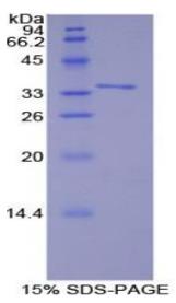SDS-PAGE (TRAF6-555H).jpg